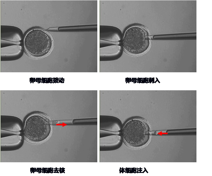 一种机器人化动物克隆技术（原位显微分析与操作仪）